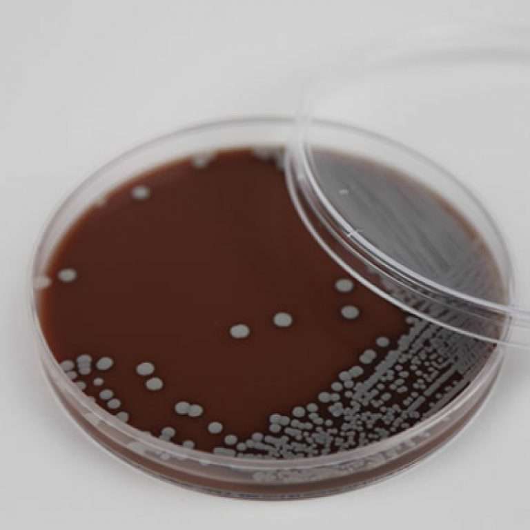 221169 BBL PLATE CHOCOLATE II AGAR 20 EA 10 PLACAS